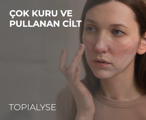 TOPIALYSE