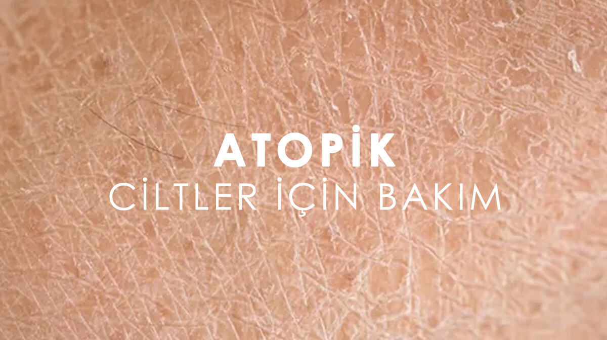 Atopik Ciltle Baş Etmenin 5 Yolu