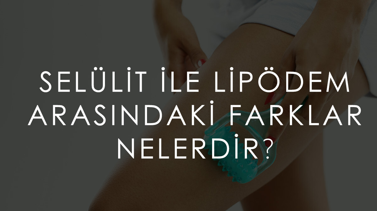 Selülit İle Lipödem Arasındaki Farklar Nelerdir?