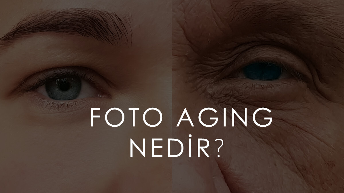 Foto Aging Nedir?