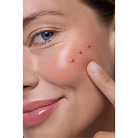 Babe Lip and Cheek Color Balm SPF 50 - Dudak ve Yanak Renklendirici Balsam Pink 20ml - 3
