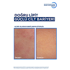 Bioderma Atoderm AD Intensive Baume - Atopi Eğilimli Cilt İçin Nemlendirici 400ml - 8