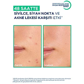Bioderma Sebium Kerato+ Anti Blemish Gel Cream - Yağlı Cilt Jel Krem 30ml - 4