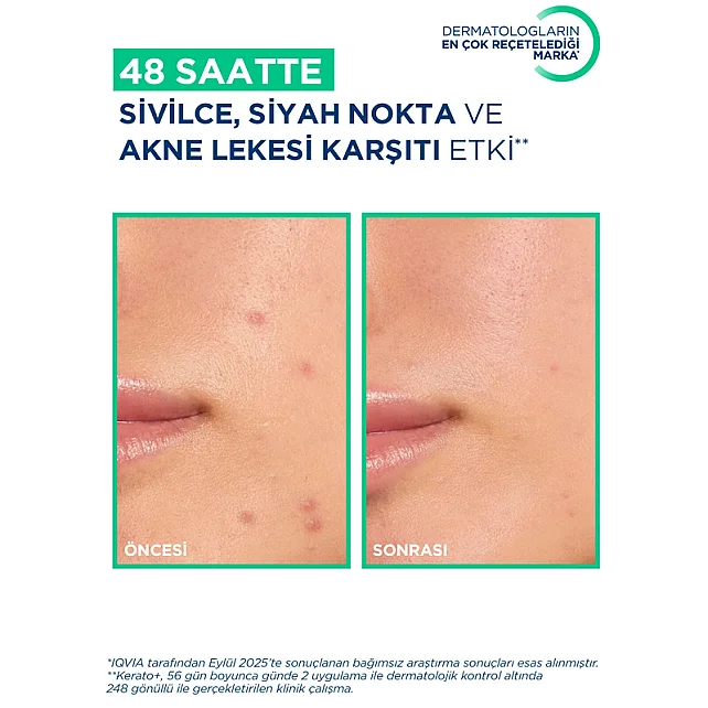 Bioderma Sebium Kerato+ Anti Blemish Gel Cream - Yağlı Cilt Jel Krem 30ml - 4