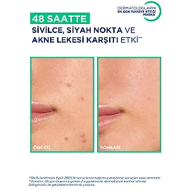Bioderma Sebium Kerato+ Anti Blemish Gel Cream - Yağlı Cilt Jel Krem 30ml - 4