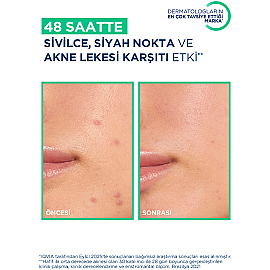 Bioderma Sebium Kerato+ Anti-Blemish Gel Cream - Yağlı Cilt Jel Krem 30ml - 4