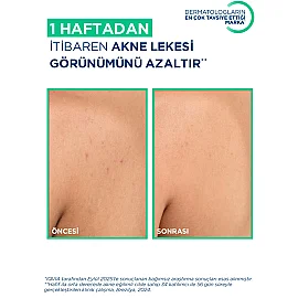 Bioderma Sebium Kerato+ Body Anti Blemish Soothing Spray - Akne Karşıtı Vücut Spreyi 150ml - 2