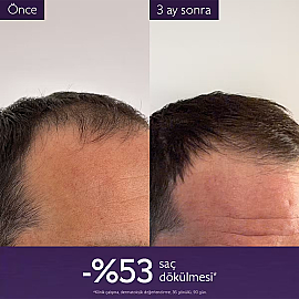 Caudalie Anti-Hair Loss - Saç Dökülmesine Karşı Serum 50ml - 4