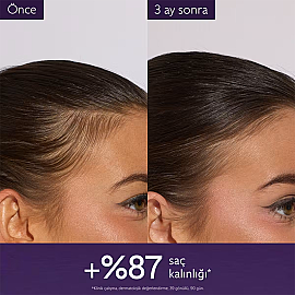 Caudalie Anti-Hair Loss - Saç Dökülmesine Karşı Serum 50ml - 5