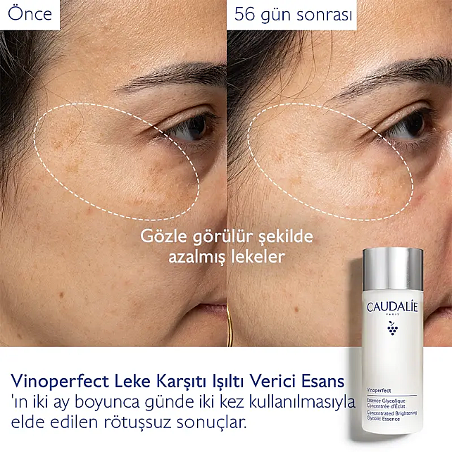 Caudalie Vinoperfect Concentrated Glycolic Brightening Essence - Aydınlatıcı Esans 100ml - 4