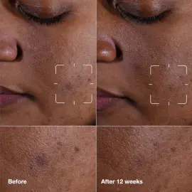 Clinique Even Better Clinical Radical Dark Spot - Leke Karşıtı Serum 30ml - 3