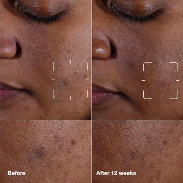 Clinique Even Better Clinical Radical Dark Spot - Leke Karşıtı Serum 30ml - 3