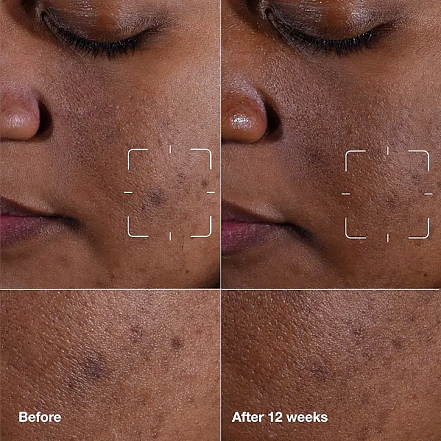 Clinique Even Better Clinical Radical Dark Spot - Leke Karşıtı Serum 30ml - 3