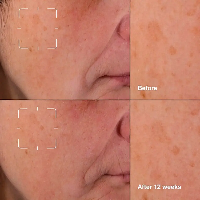 Clinique Even Better Clinical Radical Dark Spot - Leke Karşıtı Serum 30ml - 4