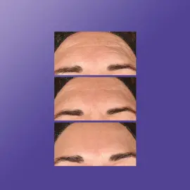 Dermalogica Phyto Nature E2 - Yaşlanma Karşıtı Bakım Ürünü 100ml - 5