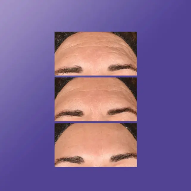 Dermalogica Phyto Nature E2 - Yaşlanma Karşıtı Bakım Ürünü 100ml - 5