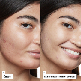 Dr.Jart+ Cicapair Tiger Grass Camo Drops SPF 35 - Yatıştırıcı Etkili Solüsyon 30ml - 5