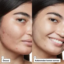 Dr.Jart+ Cicapair Tiger Grass Camo Drops SPF 35 - Yatıştırıcı Etkili Solüsyon 30ml - 5