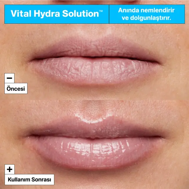 Dr.Jart+ Vital Hydra Solution - Nemlendirici Dudak Maskesi 20ml - 3