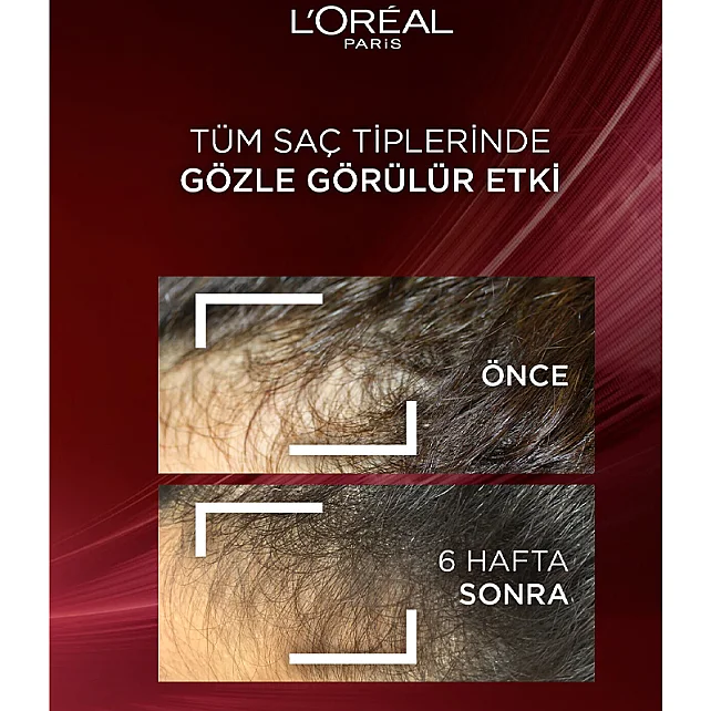 Elseve Komple Direnç - Dökülme Karşıtı Bakım Şampuanı 700ml - 5