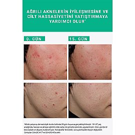 Etat Pur Pure Active Süksinik Asit %2 Konsantre Bakım Ürünü 15ml - 6