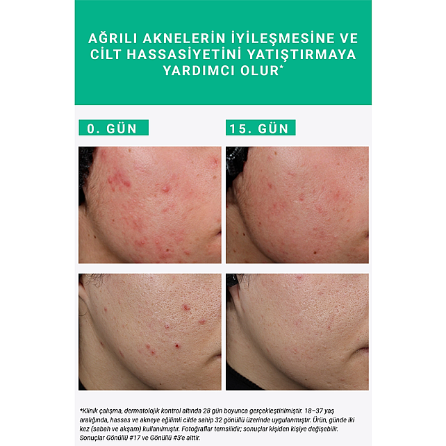 Etat Pur Pure Active Süksinik Asit %2 Konsantre Bakım Ürünü 15ml - 6