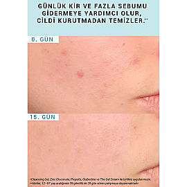 Etat Pur Pure Cleansers Purifying Cleansing Gel - Yüz Temizleme Jeli 200ml - 4
