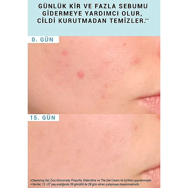 Etat Pur Pure Cleansers Purifying Cleansing Gel - Yüz Temizleme Jeli 200ml - 4