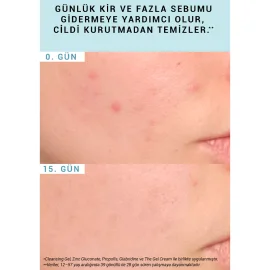 Etat Pur Pure Cleansers Purifying Cleansing Gel - Yüz Temizleme Jeli 200ml - 4