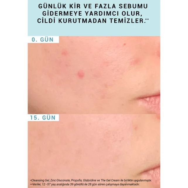 Etat Pur Pure Cleansers Purifying Cleansing Gel - Yüz Temizleme Jeli 200ml - 4