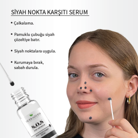 Herbaderm S.O.S S - Siyah Nokta Karşıtı Serum 20ml - 5