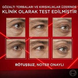 Loreal Paris Revitalift Lazer Eyebag Instant Eraser - Göz Çevresi Bakım Kremi 15ml - 5