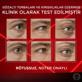 Loreal Paris Revitalift Lazer Eyebag Instant Eraser - Göz Çevresi Bakım Kremi 15ml - 5