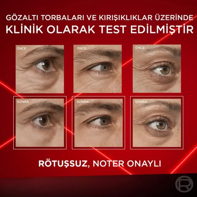 Loreal Paris Revitalift Lazer Eyebag Instant Eraser - Göz Çevresi Bakım Kremi 15ml - 5