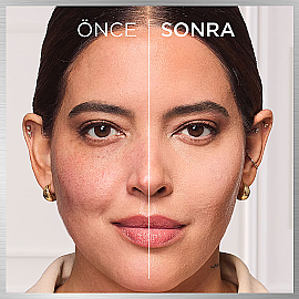 Loreal Paris True Match Hyaluron Tinted Balm Fondöten No: 4 Light Medium - 3