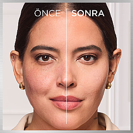 Loreal Paris True Match Hyaluron Tinted Balm Fondöten No: 4 Light Medium - 3