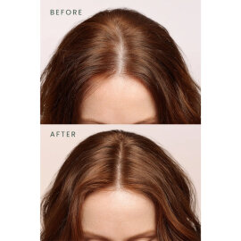 Matsu Rosemary Scalpify - Dökülme Karşıtı Saç Bakım Serumu 50ml - 5