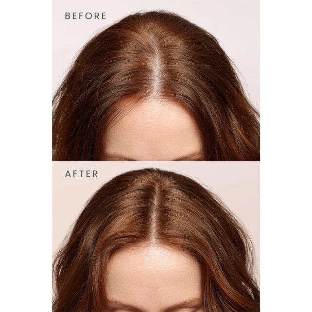 Matsu Rosemary Scalpify - Dökülme Karşıtı Saç Bakım Serumu 50ml - 5