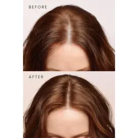 Matsu Rosemary Scalpify - Dökülme Karşıtı Saç Bakım Serumu 50ml - 5