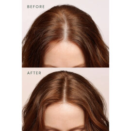 Matsu Rosemary Scalpify Root Mist - Dökülme Karşıtı Biberiye Saç Toniği 100ml - 5