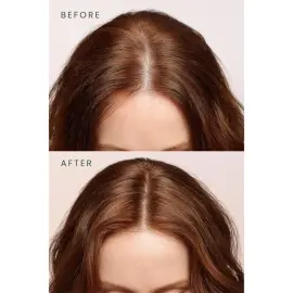 Matsu Rosemary Scalpify Root Mist - Dökülme Karşıtı Biberiye Saç Toniği 100ml - 5