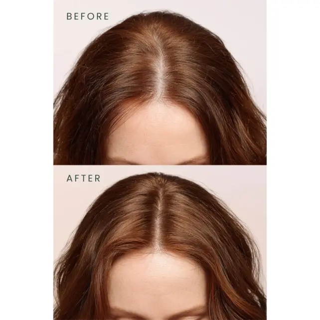 Matsu Rosemary Scalpify Root Mist - Dökülme Karşıtı Biberiye Saç Toniği 100ml - 5