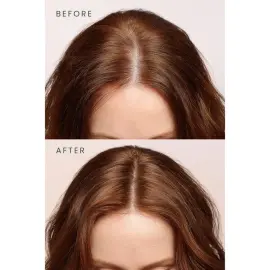 Matsu Rosemary Scalpify Shampoo - Dökülme Karşıtı Biberiye Bakım Şampuanı 350ml - 5