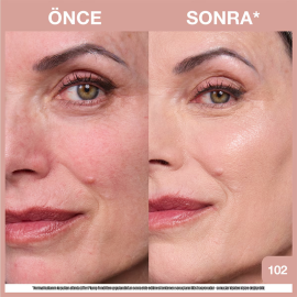 Maybelline Lifter Plump & Glow - Cilt Bakım Etkili Fondöten No: 102 - 7