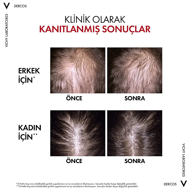Vichy Dercos Aminexil R.E.G.E.N. Booster Hair Renewing - Dökülme Karşıtı Saç Bakım Serumu 90ml - 8