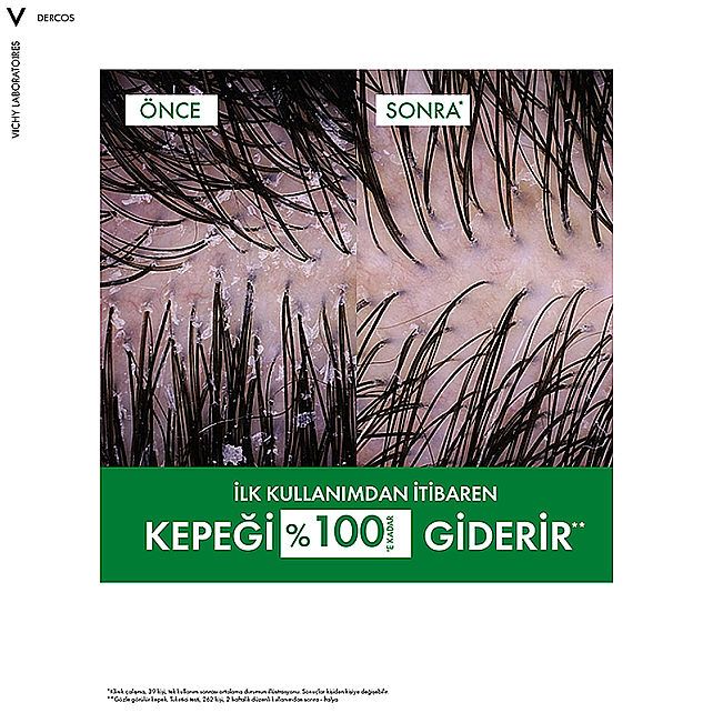 Vichy Dercos Anti Dandruff Shampoo - Kepek Karşıtı Şampuan 390ml - 5