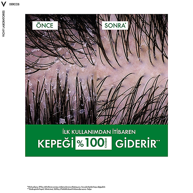 Vichy Dercos Shampoo - Yağlı Saçlar İçin Kepek Karşıtı Şampuan 390ml - 5