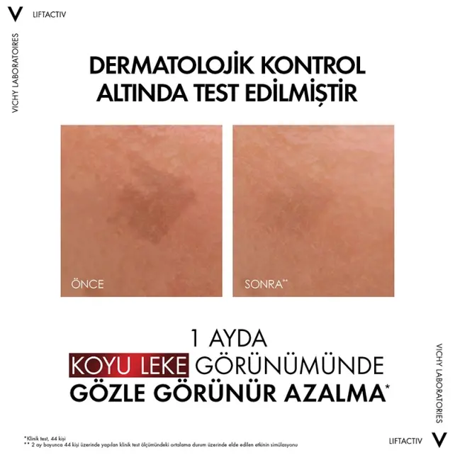 Vichy Liftactiv Specialist B3 Serum 30 ml - 5
